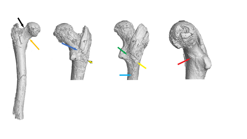 Surface-scan-images-of-femur.thumb.png.2b653ddad4ec4fb04a74975ec0824d1c.png